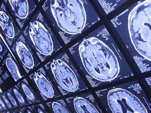 Brain activity scan in medical imaging