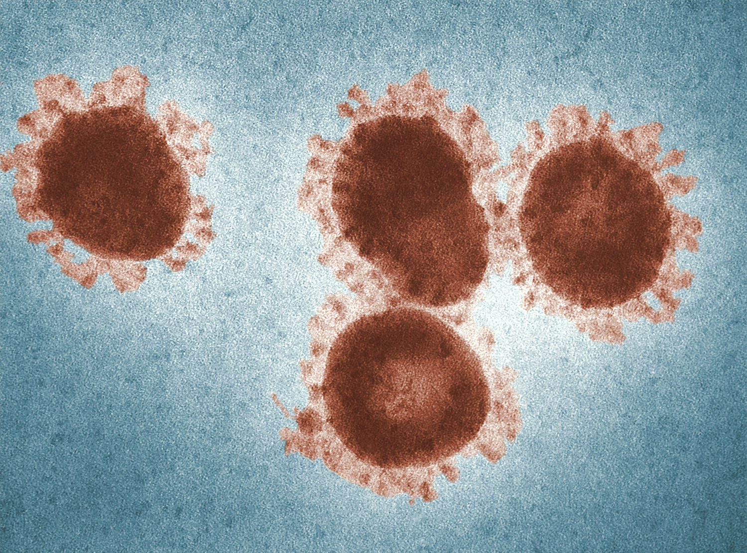 Close-up of Coronavirus disease under a microscope