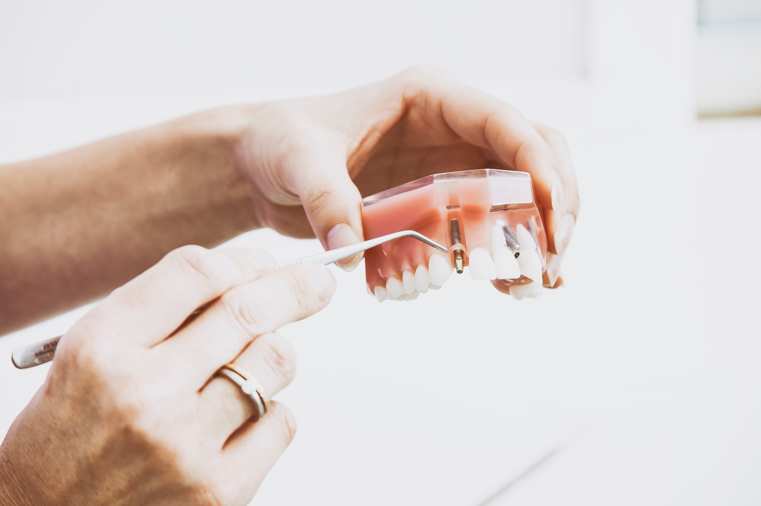 Cleaning dentures from orthodontist